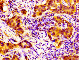 IHC image diluted at 1:100 and staining in paraffin-embedded human small intestine tissue performed on a Leica BondTM system. After dewaxing and hydration, antigen retrieval was mediated by high pressure in a citrate buffer (pH 6.0). Section was blocked with 10% normal goat serum 30min at RT. Then primary antibody (1% BSA) was incubated at 4°C overnight. The primary is detected by a biotinylated secondary antibody and visualized using an HRP conjugated SP system.