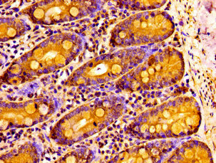 Immunofluorescence staining of Hela cells with CAC11265 at 1:133, counter-stained with DAPI. The cells were fixed in 4% formaldehyde, permeabilized using 0.2% Triton X-100 and blocked in 10% normal Goat Serum. The cells were then incubated with the antibody overnight at 4°C. The secondary antibody was Alexa Fluor 488-congugated AffiniPure Goat Anti-Rabbit IgG(H+L).