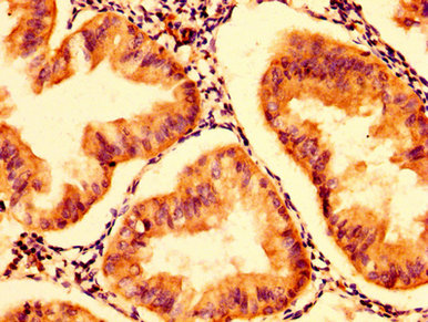 Immunofluorescence staining of PC-3 cells with CAC11280 at 1:100, counter-stained with DAPI. The cells were fixed in 4% formaldehyde, permeabilized using 0.2% Triton X-100 and blocked in 10% normal Goat Serum. The cells were then incubated with the antibody overnight at 4°C. The secondary antibody was Alexa Fluor 488-congugated AffiniPure Goat Anti-Rabbit IgG(H+L).
