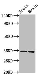 Immunofluorescence staining of HepG2 cells with CAC11283 at 1:166, counter-stained with DAPI. The cells were fixed in 4% formaldehyde, permeabilized using 0.2% Triton X-100 and blocked in 10% normal Goat Serum. The cells were then incubated with the antibody overnight at 4°C. The secondary antibody was Alexa Fluor 488-congugated AffiniPure Goat Anti-Rabbit IgG(H+L).