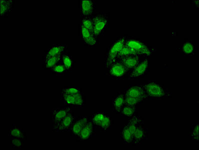 Foxe3 Polyclonal Antibody - image 3