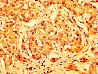 Immunofluorescence staining of HepG2 cells with CAC11286 at 1:166, counter-stained with DAPI. The cells were fixed in 4% formaldehyde, permeabilized using 0.2% Triton X-100 and blocked in 10% normal Goat Serum. The cells were then incubated with the antibody overnight at 4°C. The secondary antibody was Alexa Fluor 488-congugated AffiniPure Goat Anti-Rabbit IgG(H+L).