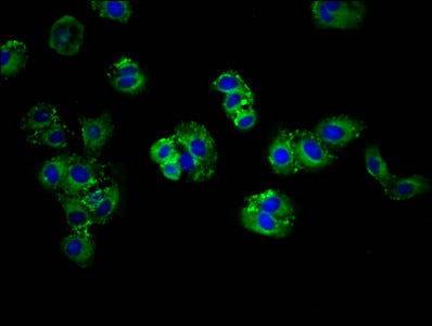 Abcg5 Polyclonal Antibody - image 5