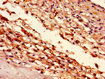 Immunofluorescent analysis of Hela cells using CAC11301 at dilution of 1:100 and Alexa Fluor 488-congugated AffiniPure Goat Anti-Rabbit IgG(H+L)