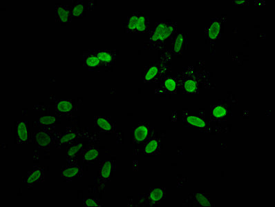 Hist1H1D (Ab-140) Polyclonal Antibody - image 4