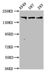 IHC image diluted at 1:400 and staining in paraffin-embedded human lung tissue performed on a Leica BondTM system. After dewaxing and hydration, antigen retrieval was mediated by high pressure in a citrate buffer (pH 6.0). Section was blocked with 10% normal goat serum 30min at RT. Then primary antibody (1% BSA) was incubated at 4°C overnight. The primary is detected by a biotinylated secondary antibody and visualized using an HRP conjugated SP system.