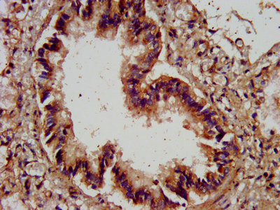 IHC image diluted at 1:400 and staining in paraffin-embedded human kidney tissue performed on a Leica BondTM system. After dewaxing and hydration, antigen retrieval was mediated by high pressure in a citrate buffer (pH 6.0). Section was blocked with 10% normal goat serum 30min at RT. Then primary antibody (1% BSA) was incubated at 4°C overnight. The primary is detected by a biotinylated secondary antibody and visualized using an HRP conjugated SP system.