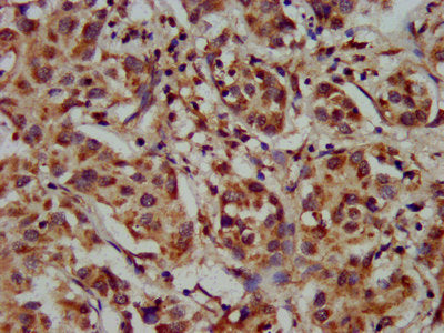 Immunofluorescence staining of HepG2 cells with CAC11309 at 1:100, counter-stained with DAPI. The cells were fixed in 4% formaldehyde, permeabilized using 0.2% Triton X-100 and blocked in 10% normal Goat Serum. The cells were then incubated with the antibody overnight at 4°C. The secondary antibody was Alexa Fluor 488-congugated AffiniPure Goat Anti-Rabbit IgG(H+L).
