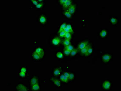 Cyp8B1 Polyclonal Antibody - image 5