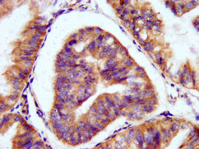 Immunofluorescence staining of Hela cells with CAC11315 at 1:66, counter-stained with DAPI. The cells were fixed in 4% formaldehyde, permeabilized using 0.2% Triton X-100 and blocked in 10% normal Goat Serum. The cells were then incubated with the antibody overnight at 4°C. The secondary antibody was Alexa Fluor 488-congugated AffiniPure Goat Anti-Rabbit IgG(H+L).