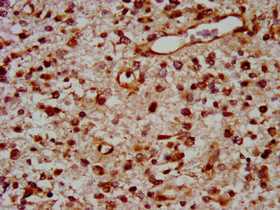 Tox Polyclonal Antibody - image 3