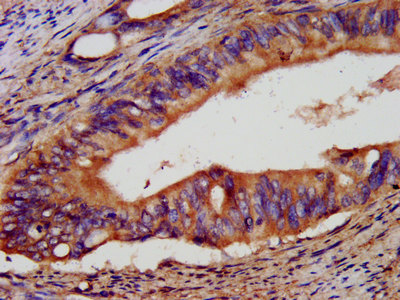 IHC image diluted at 1:400 and staining in paraffin-embedded human appendix tissue performed on a Leica BondTM system. After dewaxing and hydration, antigen retrieval was mediated by high pressure in a citrate buffer (pH 6.0). Section was blocked with 10% normal goat serum 30min at RT. Then primary antibody (1% BSA) was incubated at 4°C overnight. The primary is detected by a biotinylated secondary antibody and visualized using an HRP conjugated SP system.