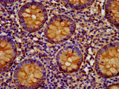 Immunofluorescence staining of MCF-7 cells with CAC11319 at 1:133, counter-stained with DAPI. The cells were fixed in 4% formaldehyde, permeabilized using 0.2% Triton X-100 and blocked in 10% normal Goat Serum. The cells were then incubated with the antibody overnight at 4°C. The secondary antibody was Alexa Fluor 488-congugated AffiniPure Goat Anti-Rabbit IgG(H+L).