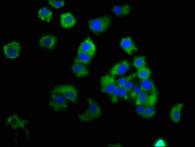 Epcam Polyclonal Antibody - image 5
