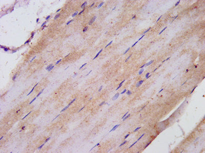 Immunofluorescence staining of Hela cells with CAC11325 at 1:100, counter-stained with DAPI. The cells were fixed in 4% formaldehyde, permeabilized using 0.2% Triton X-100 and blocked in 10% normal Goat Serum. The cells were then incubated with the antibody overnight at 4°C. The secondary antibody was Alexa Fluor 488-congugated AffiniPure Goat Anti-Rabbit IgG(H+L).