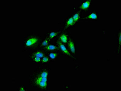 Tnip1 Polyclonal Antibody - image 4