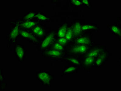 IHC image diluted at 1:200 and staining in paraffin-embedded human testis tissue performed on a Leica BondTM system. After dewaxing and hydration, antigen retrieval was mediated by high pressure in a citrate buffer (pH 6.0). Section was blocked with 10% normal goat serum 30min at RT. Then primary antibody (1% BSA) was incubated at 4°C overnight. The primary is detected by a biotinylated secondary antibody and visualized using an HRP conjugated SP system.