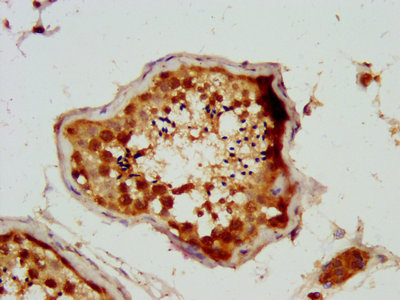 Nsun2 Polyclonal Antibody - image 4