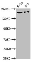 Immunofluorescence staining of SH-SY5Y cells with CAC11332 at 1:66, counter-stained with DAPI. The cells were fixed in 4% formaldehyde, permeabilized using 0.2% Triton X-100 and blocked in 10% normal Goat Serum. The cells were then incubated with the antibody overnight at 4°C. The secondary antibody was Alexa Fluor 488-congugated AffiniPure Goat Anti-Rabbit IgG(H+L).