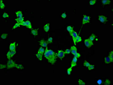 Scn10A Polyclonal Antibody - image 3
