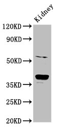 Immunofluorescence staining of 293 cells with CAC11333 at 1:66, counter-stained with DAPI. The cells were fixed in 4% formaldehyde, permeabilized using 0.2% Triton X-100 and blocked in 10% normal Goat Serum. The cells were then incubated with the antibody overnight at 4°C. The secondary antibody was Alexa Fluor 488-congugated AffiniPure Goat Anti-Rabbit IgG(H+L).