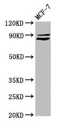 Immunofluorescence staining of SH-SY5Y cells with CAC11342 at 1:100, counter-stained with DAPI. The cells were fixed in 4% formaldehyde, permeabilized using 0.2% Triton X-100 and blocked in 10% normal Goat Serum. The cells were then incubated with the antibody overnight at 4°C. The secondary antibody was Alexa Fluor 488-congugated AffiniPure Goat Anti-Rabbit IgG(H+L).