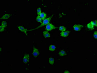 Med15 Polyclonal Antibody - image 3