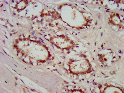 IHC image diluted at 1:800 and staining in paraffin-embedded human small intestine tissue performed on a Leica BondTM system. After dewaxing and hydration, antigen retrieval was mediated by high pressure in a citrate buffer (pH 6.0). Section was blocked with 10% normal goat serum 30min at RT. Then primary antibody (1% BSA) was incubated at 4°C overnight. The primary is detected by a biotinylated secondary antibody and visualized using an HRP conjugated SP system.
