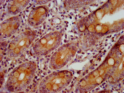 Immunofluorescence staining of HepG2 cells with CAC11347 at 1:266, counter-stained with DAPI. The cells were fixed in 4% formaldehyde, permeabilized using 0.2% Triton X-100 and blocked in 10% normal Goat Serum. The cells were then incubated with the antibody overnight at 4°C. The secondary antibody was Alexa Fluor 488-congugated AffiniPure Goat Anti-Rabbit IgG(H+L).
