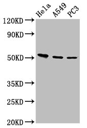 Immunofluorescence staining of A549 cells with CAC11348 at 1:100, counter-stained with DAPI. The cells were fixed in 4% formaldehyde, permeabilized using 0.2% Triton X-100 and blocked in 10% normal Goat Serum. The cells were then incubated with the antibody overnight at 4°C. The secondary antibody was Alexa Fluor 488-congugated AffiniPure Goat Anti-Rabbit IgG(H+L).