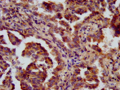 Immunofluorescence staining of Hela cells with CAC11359 at 1:200, counter-stained with DAPI. The cells were fixed in 4% formaldehyde, permeabilized using 0.2% Triton X-100 and blocked in 10% normal Goat Serum. The cells were then incubated with the antibody overnight at 4°C. The secondary antibody was Alexa Fluor 488-congugated AffiniPure Goat Anti-Rabbit IgG(H+L).