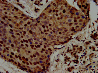 Immunofluorescence staining of Hela cells with CAC11363 at 1:167, counter-stained with DAPI. The cells were fixed in 4% formaldehyde, permeabilized using 0.2% Triton X-100 and blocked in 10% normal Goat Serum. The cells were then incubated with the antibody overnight at 4°C. The secondary antibody was Alexa Fluor 488-congugated AffiniPure Goat Anti-Rabbit IgG(H+L).