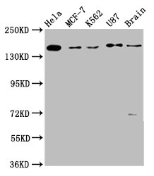 Immunofluorescence staining of Hela cells with CAC11365 at 1:200, counter-stained with DAPI. The cells were fixed in 4% formaldehyde, permeabilized using 0.2% Triton X-100 and blocked in 10% normal Goat Serum. The cells were then incubated with the antibody overnight at 4°C. The secondary antibody was Alexa Fluor 488-congugated AffiniPure Goat Anti-Rabbit IgG(H+L).