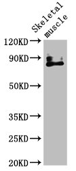 Immunofluorescence staining of HepG2 cells with CAC11366 at 1:266, counter-stained with DAPI. The cells were fixed in 4% formaldehyde, permeabilized using 0.2% Triton X-100 and blocked in 10% normal Goat Serum. The cells were then incubated with the antibody overnight at 4°C. The secondary antibody was Alexa Fluor 488-congugated AffiniPure Goat Anti-Rabbit IgG(H+L).