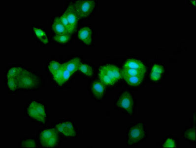 IHC image diluted at 1:800 and staining in paraffin-embedded human prostate tissue performed on a Leica BondTM system. After dewaxing and hydration, antigen retrieval was mediated by high pressure in a citrate buffer (pH 6.0). Section was blocked with 10% normal goat serum 30min at RT. Then primary antibody (1% BSA) was incubated at 4°C overnight. The primary is detected by a biotinylated secondary antibody and visualized using an HRP conjugated SP system.