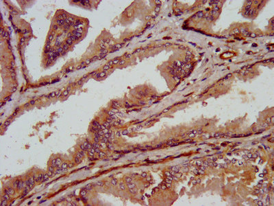Trpv2 Polyclonal Antibody - image 4