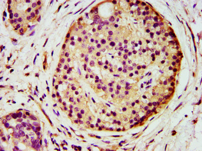 Immunofluorescence staining of NIH/3T3 cells with CAC11368 at 1:166, counter-stained with DAPI. The cells were fixed in 4% formaldehyde, permeabilized using 0.2% Triton X-100 and blocked in 10% normal Goat Serum. The cells were then incubated with the antibody overnight at 4°C. The secondary antibody was Alexa Fluor 488-congugated AffiniPure Goat Anti-Rabbit IgG(H+L).