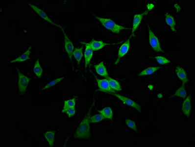 Agps Polyclonal Antibody - image 4