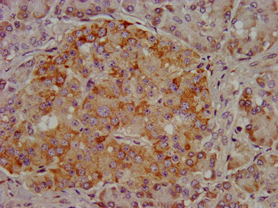 Immunofluorescence staining of HepG2 cells with CAC11369 at 1:133, counter-stained with DAPI. The cells were fixed in 4% formaldehyde, permeabilized using 0.2% Triton X-100 and blocked in 10% normal Goat Serum. The cells were then incubated with the antibody overnight at 4°C. The secondary antibody was Alexa Fluor 488-congugated AffiniPure Goat Anti-Rabbit IgG(H+L).