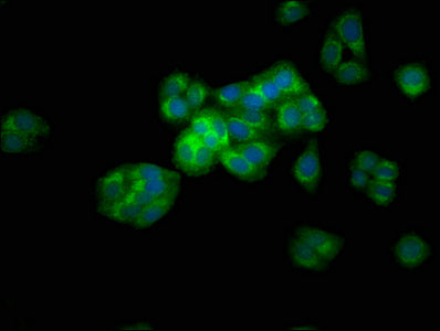 Arse Polyclonal Antibody - image 4