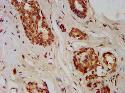 Immunofluorescence staining of Hela cells with CAC11375 at 1:133, counter-stained with DAPI. The cells were fixed in 4% formaldehyde, permeabilized using 0.2% Triton X-100 and blocked in 10% normal Goat Serum. The cells were then incubated with the antibody overnight at 4°C. The secondary antibody was Alexa Fluor 488-congugated AffiniPure Goat Anti-Rabbit IgG(H+L).