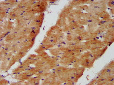 IHC image diluted at 1:400 and staining in paraffin-embedded human kidney tissue performed on a Leica BondTM system. After dewaxing and hydration, antigen retrieval was mediated by high pressure in a citrate buffer (pH 6.0). Section was blocked with 10% normal goat serum 30min at RT. Then primary antibody (1% BSA) was incubated at 4°C overnight. The primary is detected by a biotinylated secondary antibody and visualized using an HRP conjugated SP system.