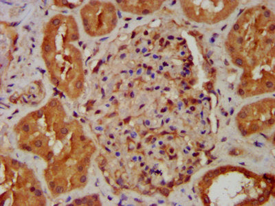 Ndufb8 Polyclonal Antibody - image 4