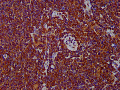 IHC image diluted at 1:400 and staining in paraffin-embedded human pancreatic tissue performed on a Leica BondTM system. After dewaxing and hydration, antigen retrieval was mediated by high pressure in a citrate buffer (pH 6.0). Section was blocked with 10% normal goat serum 30min at RT. Then primary antibody (1% BSA) was incubated at 4°C overnight. The primary is detected by a biotinylated secondary antibody and visualized using an HRP conjugated SP system.