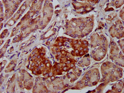 Immunofluorescence staining of MCF-7 cells with CAC11385 at 1:133, counter-stained with DAPI. The cells were fixed in 4% formaldehyde, permeabilized using 0.2% Triton X-100 and blocked in 10% normal Goat Serum. The cells were then incubated with the antibody overnight at 4°C. The secondary antibody was Alexa Fluor 488-congugated AffiniPure Goat Anti-Rabbit IgG(H+L).