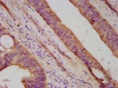 Immunofluorescence staining of A549 cells with CAC11392 at 1:166, counter-stained with DAPI. The cells were fixed in 4% formaldehyde, permeabilized using 0.2% Triton X-100 and blocked in 10% normal Goat Serum. The cells were then incubated with the antibody overnight at 4°C. The secondary antibody was Alexa Fluor 488-congugated AffiniPure Goat Anti-Rabbit IgG(H+L).