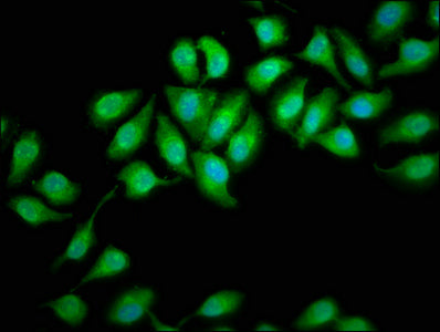 Dhx34 Polyclonal Antibody - image 4