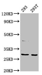 Immunofluorescence staining of A549 cells with CAC11394 at 1:133, counter-stained with DAPI. The cells were fixed in 4% formaldehyde, permeabilized using 0.2% Triton X-100 and blocked in 10% normal Goat Serum. The cells were then incubated with the antibody overnight at 4°C. The secondary antibody was Alexa Fluor 488-congugated AffiniPure Goat Anti-Rabbit IgG(H+L).