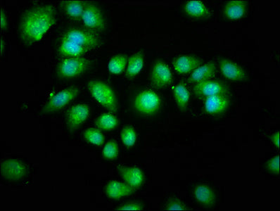 Aanat Polyclonal Antibody - image 3