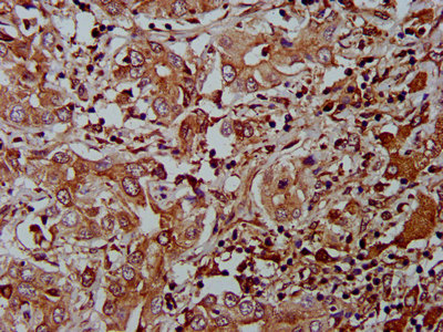 IHC image diluted at 1:400 and staining in paraffin-embedded human brain tissue performed on a Leica BondTM system. After dewaxing and hydration, antigen retrieval was mediated by high pressure in a citrate buffer (pH 6.0). Section was blocked with 10% normal goat serum 30min at RT. Then primary antibody (1% BSA) was incubated at 4°C overnight. The primary is detected by a biotinylated secondary antibody and visualized using an HRP conjugated SP system.